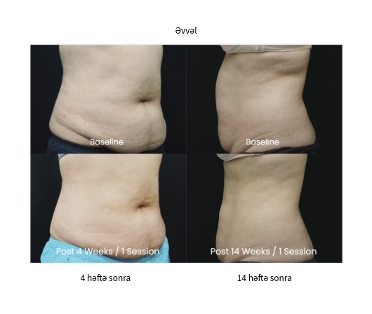 Classys Clatuu Alpha